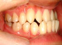 矯正治療の流れ 歯及び顔の写真　菊地歯科クリニック